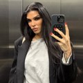 "Gledam kako mi se kosa stanjuje i opada" Jedna od najfatalnijih Srpkinja zbog frizure saznala da ima problem sa zdravljem…