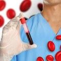 Testovi koji proveravaju nivo gvožđa: Jedan nije dovoljan – evo i zašto