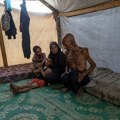 Više od 6.000 palestinske dece se leči od neuhranjenosti u Gazi