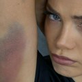 Celo telo u podlivima: Milica Pavlović se povredila na snimanju spotova za novi album "Caka" (foto)
