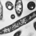 Prvi smrtni slučaj u epidemiji legionarske bolesti u Njujorku