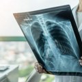 HOBP: Simptomi, uzroci i lečenje hronično opstruktivne bolesti pluća
