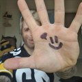Majka ga se odrekla u porodilištu jer mu je lice deformisano: Našao ju je kad je odrastao, a ona mu sipala so na ranu