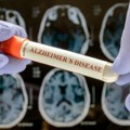 Zašto se rak i Alchajmer gotovo nikad ne javljaju zajedno? Naučnici konačno imaju odgovor