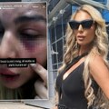 "Ne želim da me gledaju kao žrtvu" Pretučena Ava Karabatić iznela nove detalje, evo šta planira da uradi (foto)