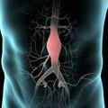 Dan aorte: Kako rana dijagnoza može spasiti živote?