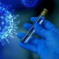 Virus gripe potvrđen u Srbiji! Broj oboleleih raste iz dana u dan evo koji su prvi simptomi i kako se zaštititi