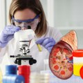 Zašto je pregled sedimenta urina ključan za zdravlje bubrega? Evo kako se radi i šta otkriva