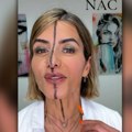 Ubrizgavala sam botoks samo u desnu stranu lica i pogledajte šta mi se desilo: Potpuno isto može i vama da se dogodi (video)