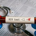 Besplatno i anonimno testiranje na HIV: Savremena terapija čini virus nezaraznim, ali samo ako se na vreme otkrije