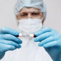 Potvrđen prvi slučaj majmunskih boginja u Severnoj Makedoniji