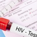 Naučnici razvili metodu za uništavanje virusa HIV u laboratorijskim uslovima