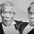 Spavali u specijalnom krevetu, a umrli istog dana: Ovo su bili prvi sijamski blizanci koji su imali žene i ukupno 21 dete…