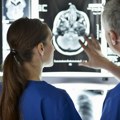 Nešto se neobično dogodi sa mozgom posle 40. godine života – evo šta je skener pokazao