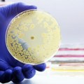 Samo jedna doza nove klase antibiotika uništila jednu od najopasnijih bakterija