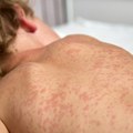 Opasna zaraza buknula u komšiluku! Ovuda Srbi masovno putuju na more, stručnjaci upalili alarm: Jedna osoba može da zarazi do…