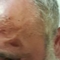 Policiji dobacio da „hapse kriminalce“, oni ga pretukli pred detetom, pa pretili Centrom za socijalni rad
