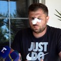 Srbin napadnut u Donjoj Brnjici, nanete mu povrede u predelu glave