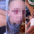 "Blic" saznaje: Dečak (7) kojeg je školski drug gurnuo niz stepenice primljen u bolnicu, oglasila se majka: "stanje mu se…