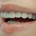 Estetska stomatologija u Branko Dental Tehnu