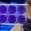 Veštačka inteligencija dizajnirala viruse koji napadaju bakterije: Stručnjaci upozoravaju na potencijalne rizike