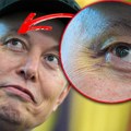 Mask stajao uz Trampa sa masnicom ispod oka: Nakon priče o tuči u Beloj kući pokušao je da objasni šta se desilo (foto)