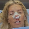 Odbornica "Kreni-promeni" operisana nakon napada Aleksandra Šapića: Zadobila prelome kostiju nosa i vilice FOTO