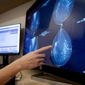 Veštačka inteligencija unapred predviđa rizik od raka dojke