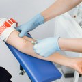 Povišeni trombociti: Evo šta taj nalaz može da znači i kada treba kod hematologa