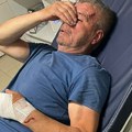 Horor u Kosovskom Pomoravlju! Branio sina od pomahnitalog komšije, pa završio u bolnici