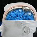 Prvi čovek kojem je ugrađen moždani implant upravlja mišem pomoću misli