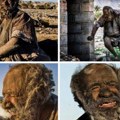 60 Година није користио воду и сапун Ово је најпрљавији човек на свету (фото/видео)