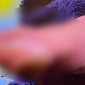 Procurila jeziva fotografija Novakovog žulja tokom meča na US Openu: Ovaj prizor je zabrinjavajuć