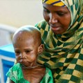 Svako drugo dete u Somaliji neuhranjeno