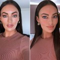 Posle 39 godina mučenja, dobila sam dijagnozu! Lepotica koju znate s Instagrama ima poremećaj čije simptome svi ignorišu