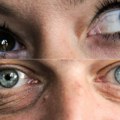 Kad zatvorite oči vidite bele tačkice i mrlje? Nauka otkriva šta znače: Nije strašno sve dok se ne pojave ovi simptomi