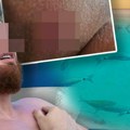 "Kida komad mesa s noge, bukvalno"! Srbin se kupao u Grčkoj, pa iz vode izašao sa jezivom ranom od ugriza ribe