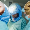 Zemlja odobrila transplantaciju životinjskih organa kod ljudi: U slučaju infekcije sledi ovo