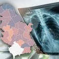 Jeziva mapa: U ovim delovima Srbije ima najviše obolelih od raka, a evo koje tri vrste karcinoma ima najviše pacijenata