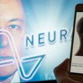 Neuralink: Kompanija Ilona Maska ugradila moždani čip u čoveka - „Telepatija će pomoći bolesnima"