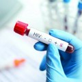 Šest pacijenata u Brazilu dobilo HIV virus: Organi za transplataciju su se pokazali pozitivni na test