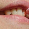 Najvažniji vitamini za zube i desni – bitno je da ih unosite svaki dan