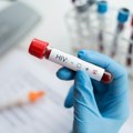 Evropska nedelja testiranja na HIV i hepatitise: Od danas do 26. maja FOTO