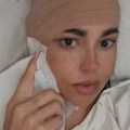 Zavijena glava, gazu drži na licu: Ovako izgleda Dijana Diline nakon operacije: Intervencija trajala tri i po sata, evo detalja…