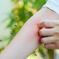 Magnet za komarce: 3 razloga zašto dosadne krvopije ujedaju neke ljude više od drugih