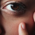 Брига о кожи почиње превенцијом, не игноришите промене