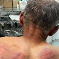 Stanje Srbina koji je pretučen na KiM nije stabilno, srpske NVO pišu Briselu