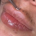 Žene počele da rade nadogradnju brkova, i svi su zgroženi: "Bolje bi ti bilo da ugradiš mozak"