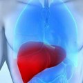 Odobren prvi lek za masnu jetru Konačno spas za pretnje od dijabetesa i transplantacije