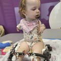 Tužna prognoza za srpsku "bebu sa krilima": Irina (2) nema kolena, ni ruke! Iz Bora stiže srceparajući vapaj